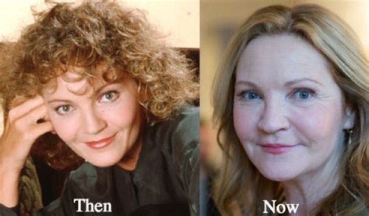 Joan Allen Plastic Surgery Before and After