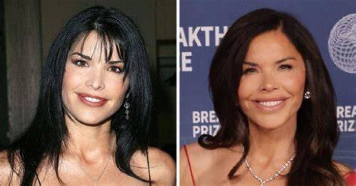 Lauren Sanchez Plastic Surgery: From Nose Job to Facelift Everything We Know!