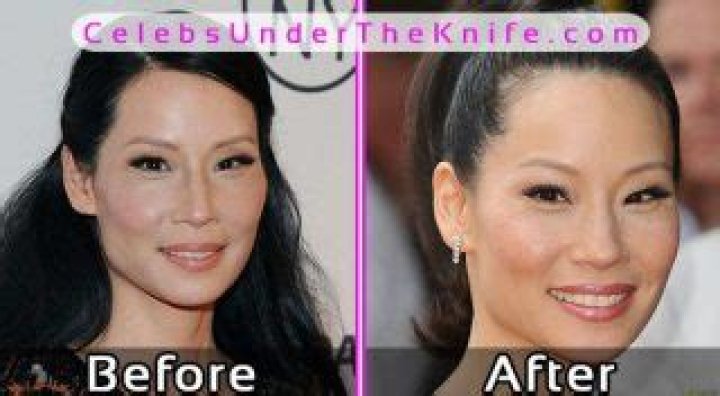 Lucy Liu Plastic Surgery Before and After