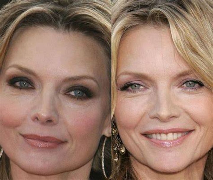 Michelle Pfeiffer Plastic Surgery Before and After